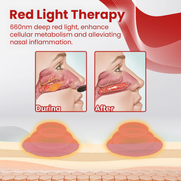 ClearCare Red Light Nasal Therapy