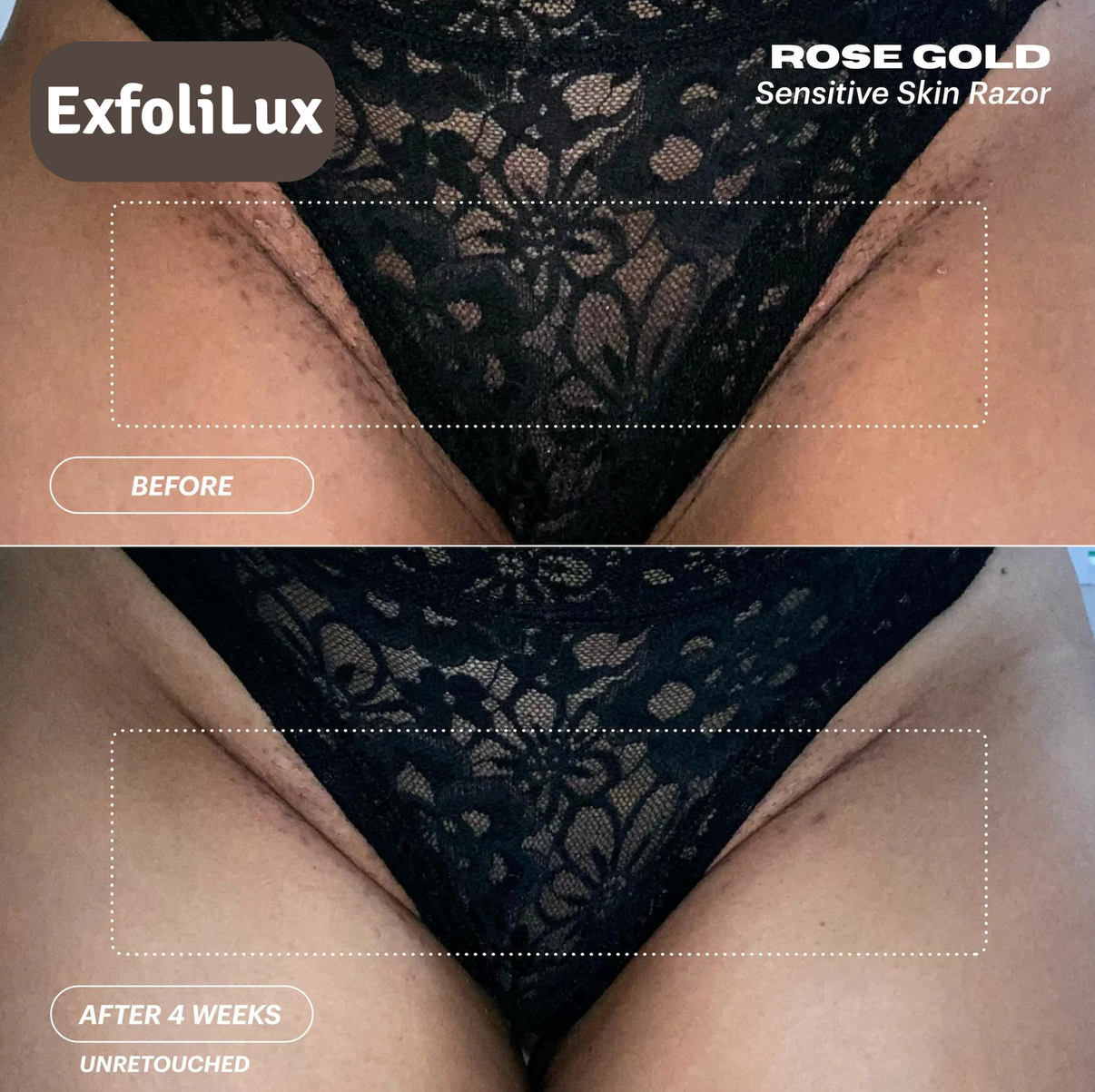 ExfoliLux Glide 2.0