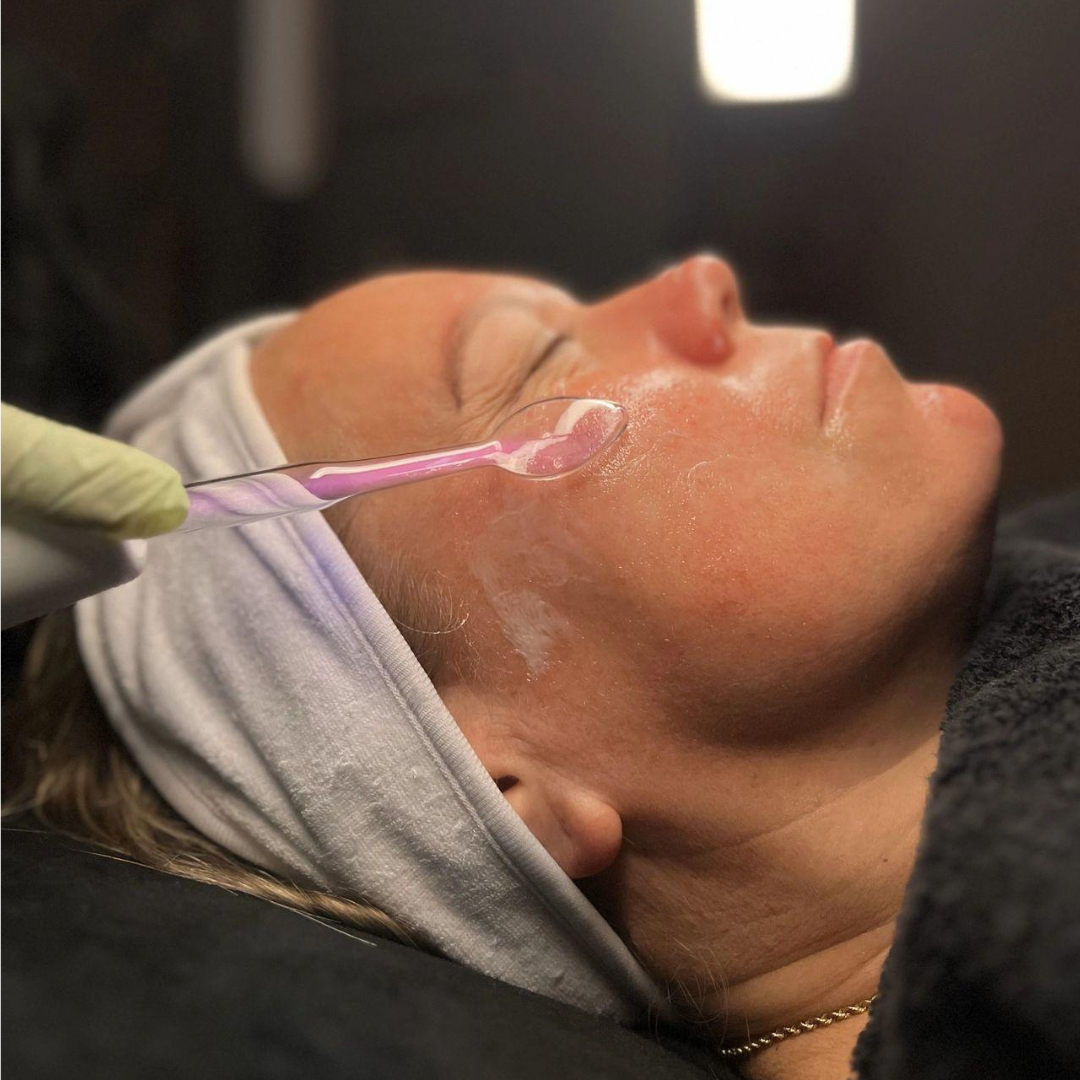 High-Frequency Facial Wand V2 with Fusion Applicators (Argon + Neon)