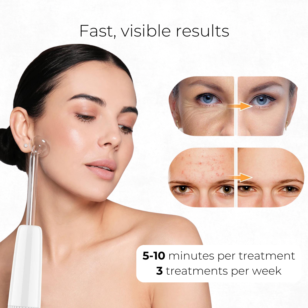 High-Frequency Facial Wand V2 with Fusion Applicators (Argon + Neon)