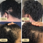 Limited Time 50% off - Natural Hair Growth Oil