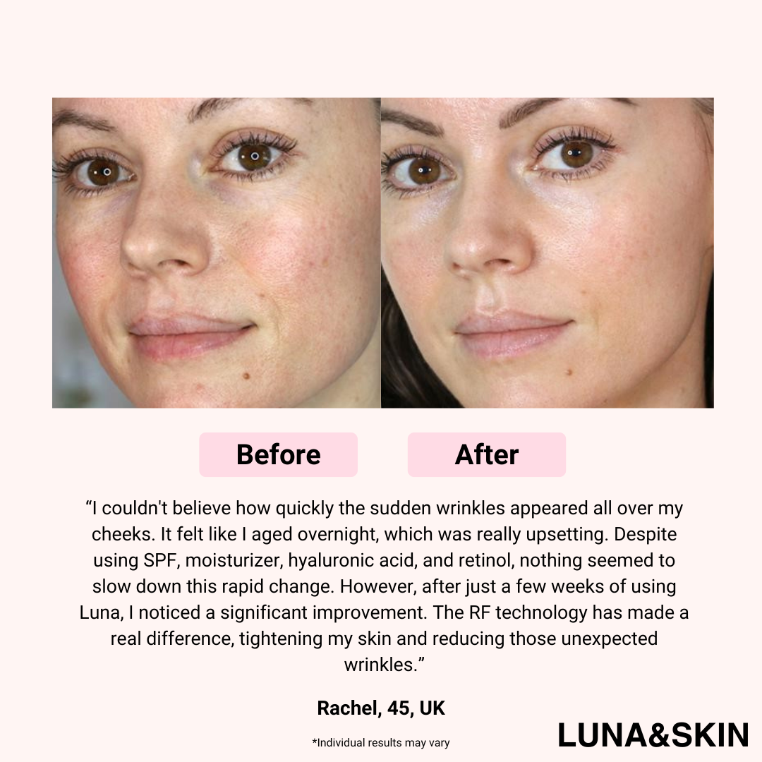 Luna&Skin Booster Pro