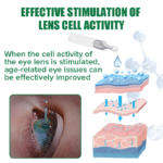 OptiRev Eye Drops for Presbyopia Rehabilitation