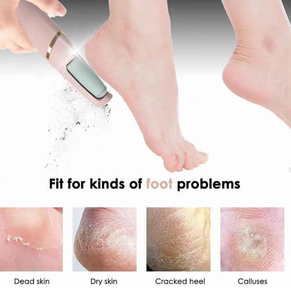 Smooth Pedicure Wand