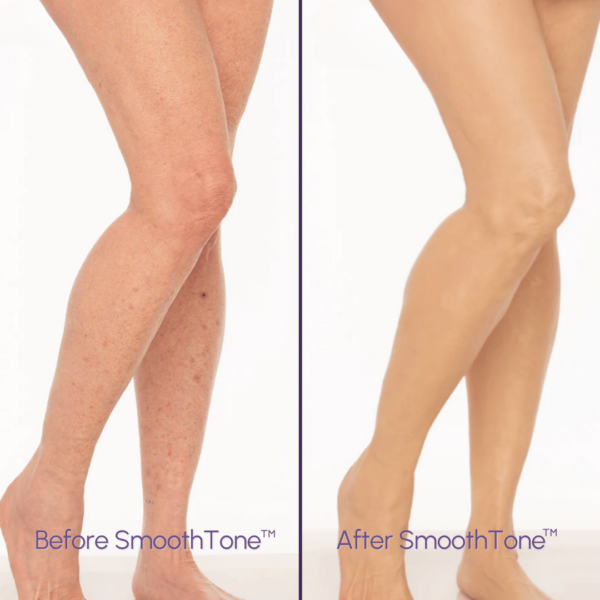 SmoothTone - Full Coverage Body Makeup