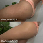 SmoothTone - Full Coverage Body Makeup