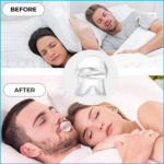 SnoreShield - Anti Snoring Device