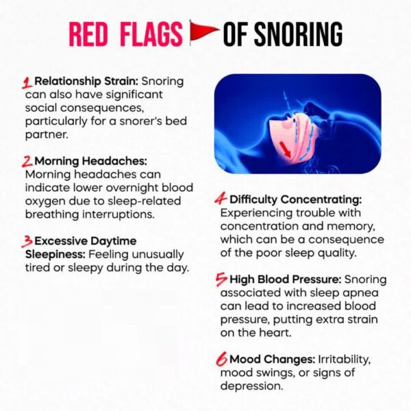 SnorMed Anti-Snoring Mouthpiece