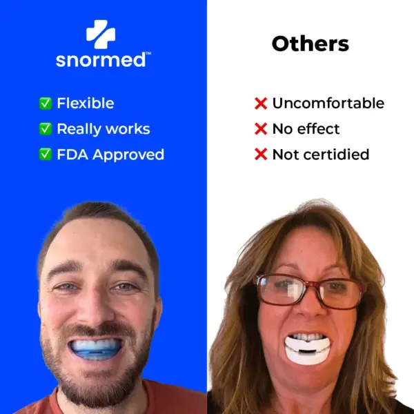 SnorMed Anti-Snoring Mouthpiece