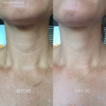 Tighten & Lift Neck Cream