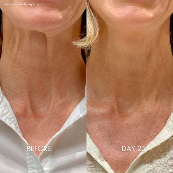 Tighten & Lift Neck Cream