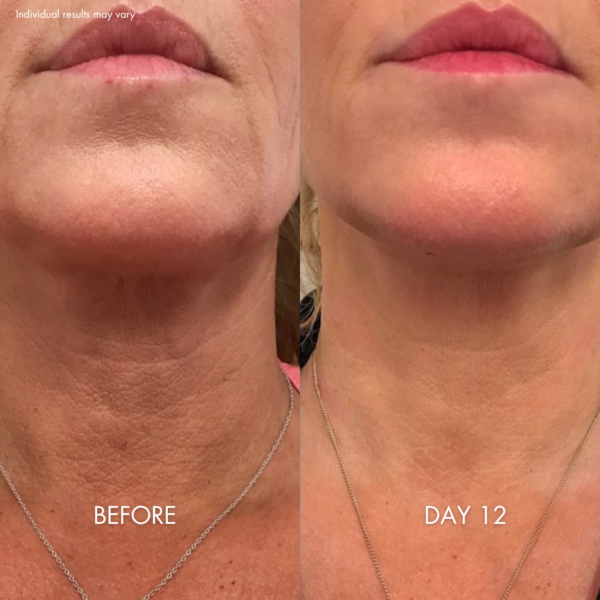 Tighten & Lift Neck Cream