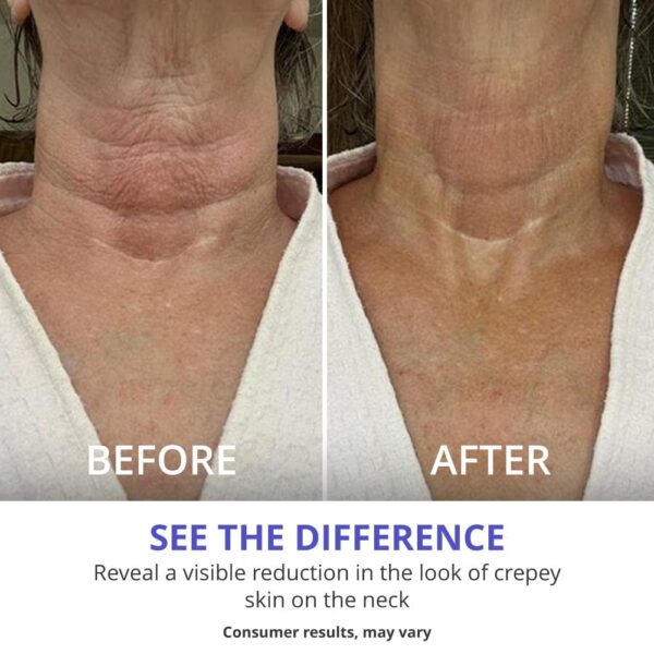 Tighten & Lift Neck Cream