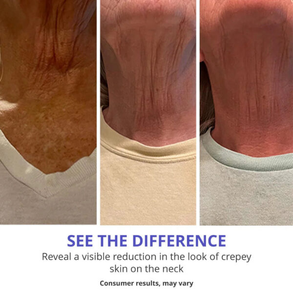 Tightening Neck Lift Cream