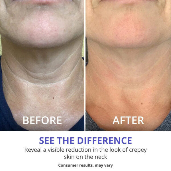 Tightening Neck Lift Cream