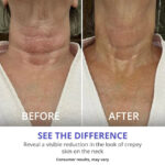 Tightening Neck Lift Cream