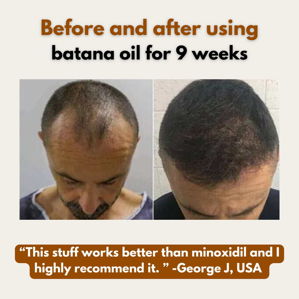 100% Organic Batana Oil for Hair Growth 4oz