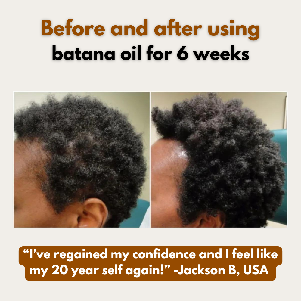 100% Organic Batana Oil for Hair Growth 4oz