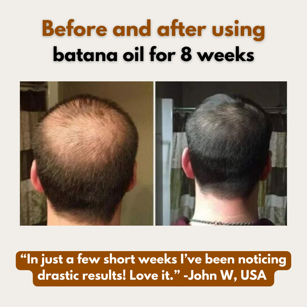 100% Organic Batana Oil for Hair Growth 4oz