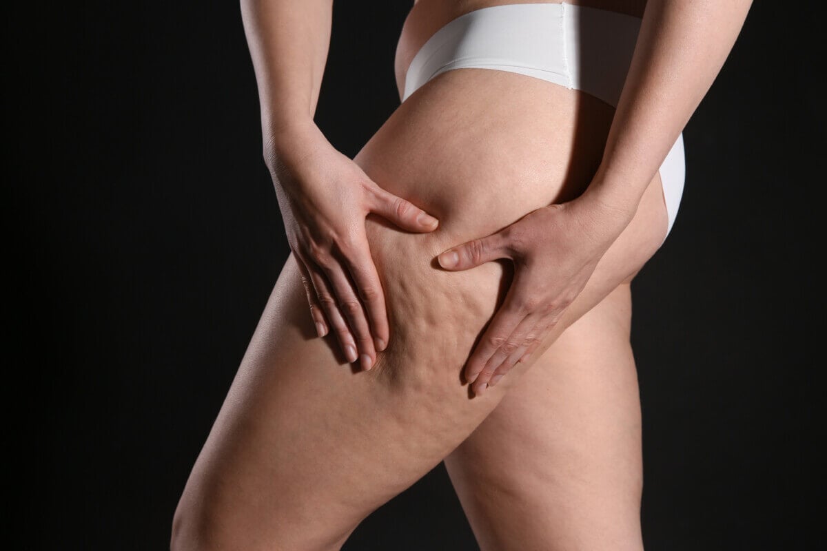 Painless Cellulite treatment