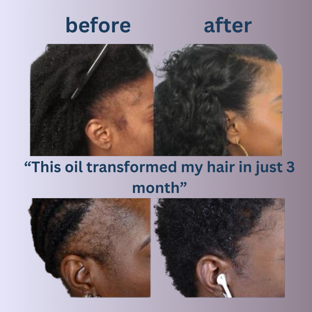 Batana Hair Growth Oil