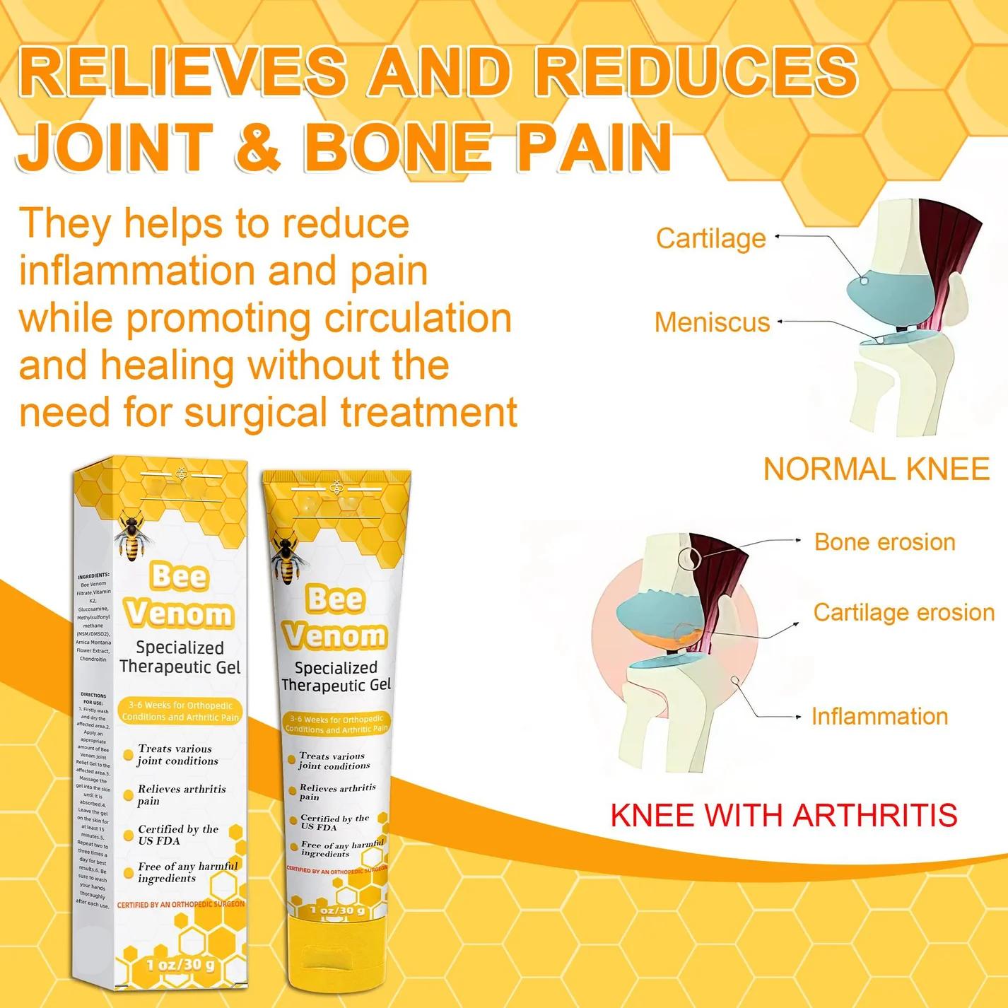 Bee Venom Joint Therapy Pain Relief Gel (New Zealand Bee Extract - Specializes in Orthopedic Diseases and Arthritis Pain)