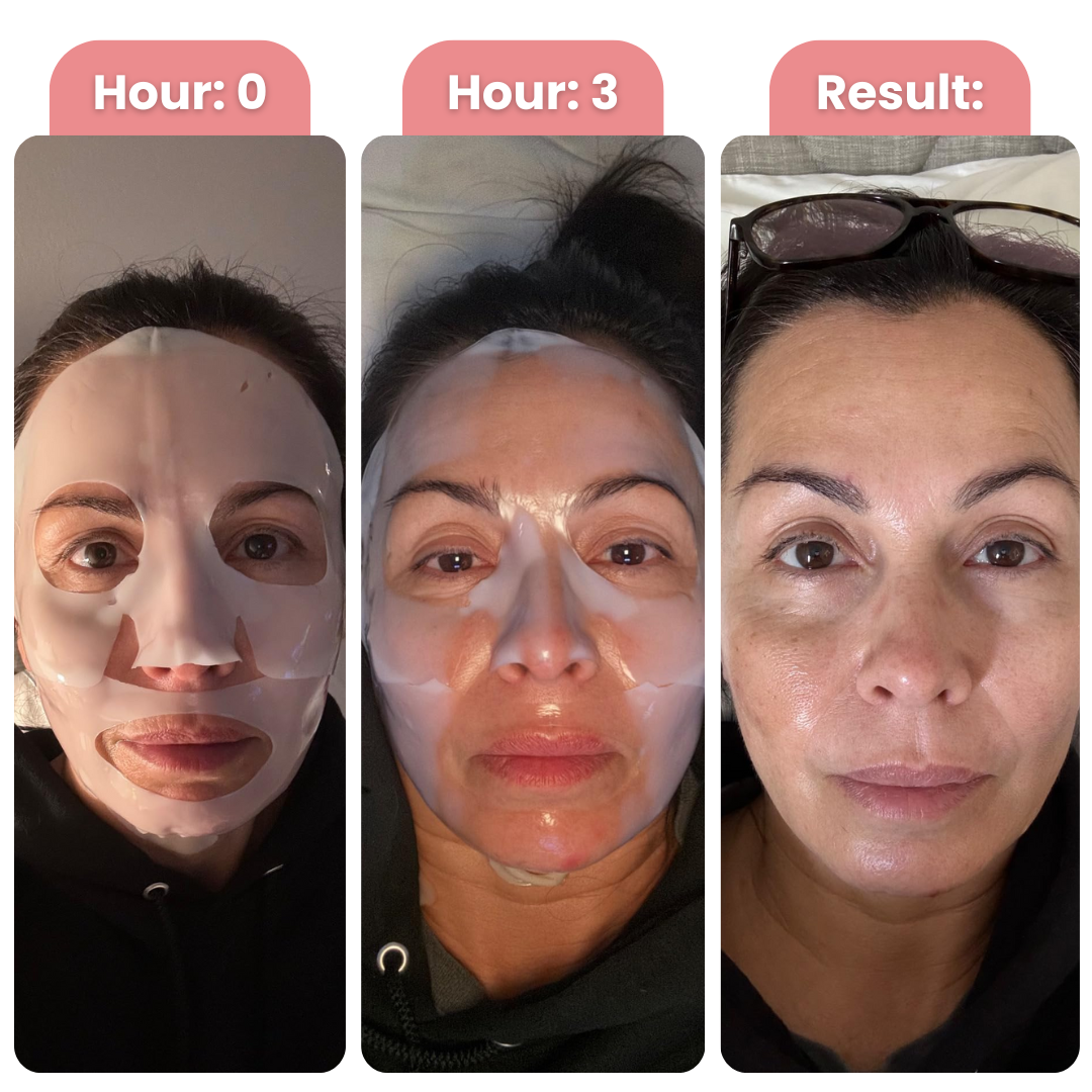 Bio-Collagen Mask Treatment