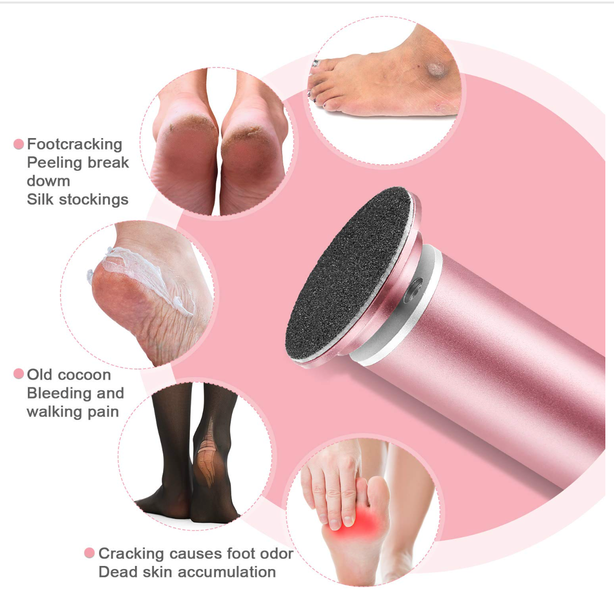 Electric Foot Callus Remover