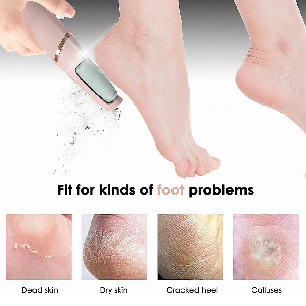 Probezon Foot Callus Shaver