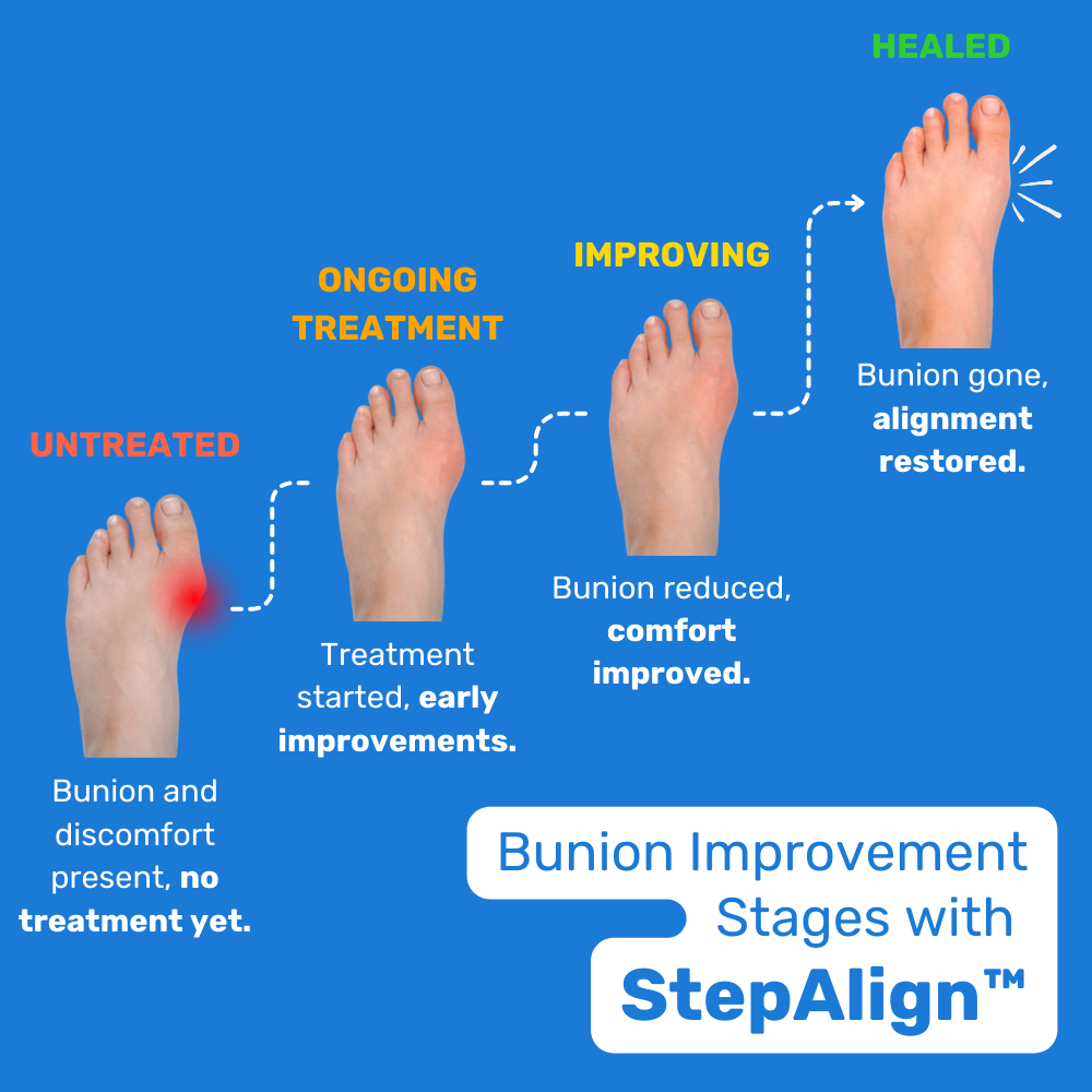 StepAlign