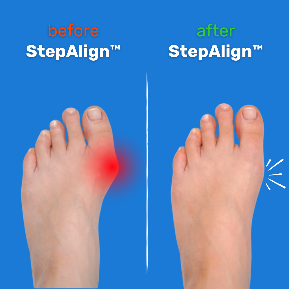 StepAlign