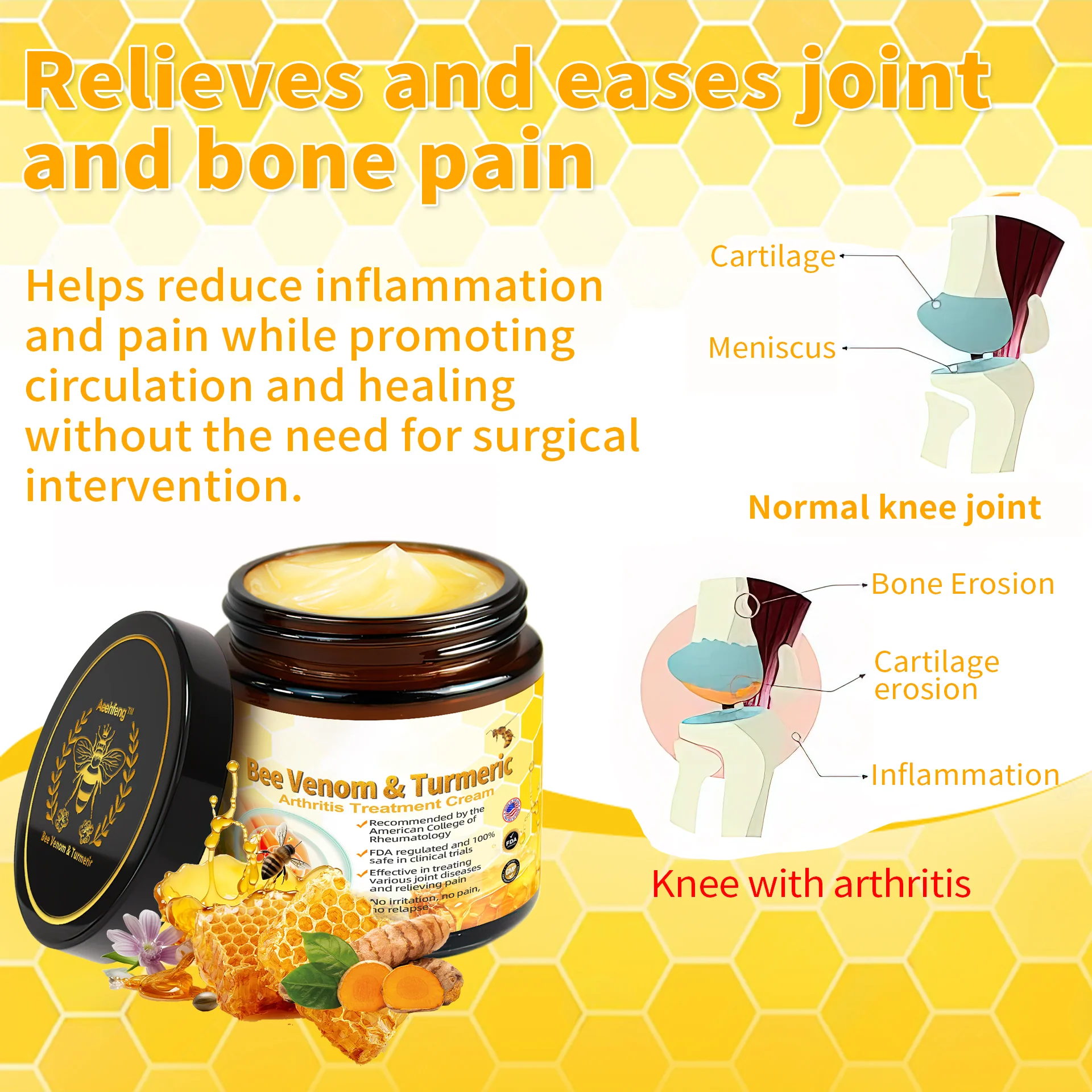 Aeehfeng Bee Venom&Turmeric Arthritis Treatment Cream (Specializing in orthopedic conditions and joint pain)