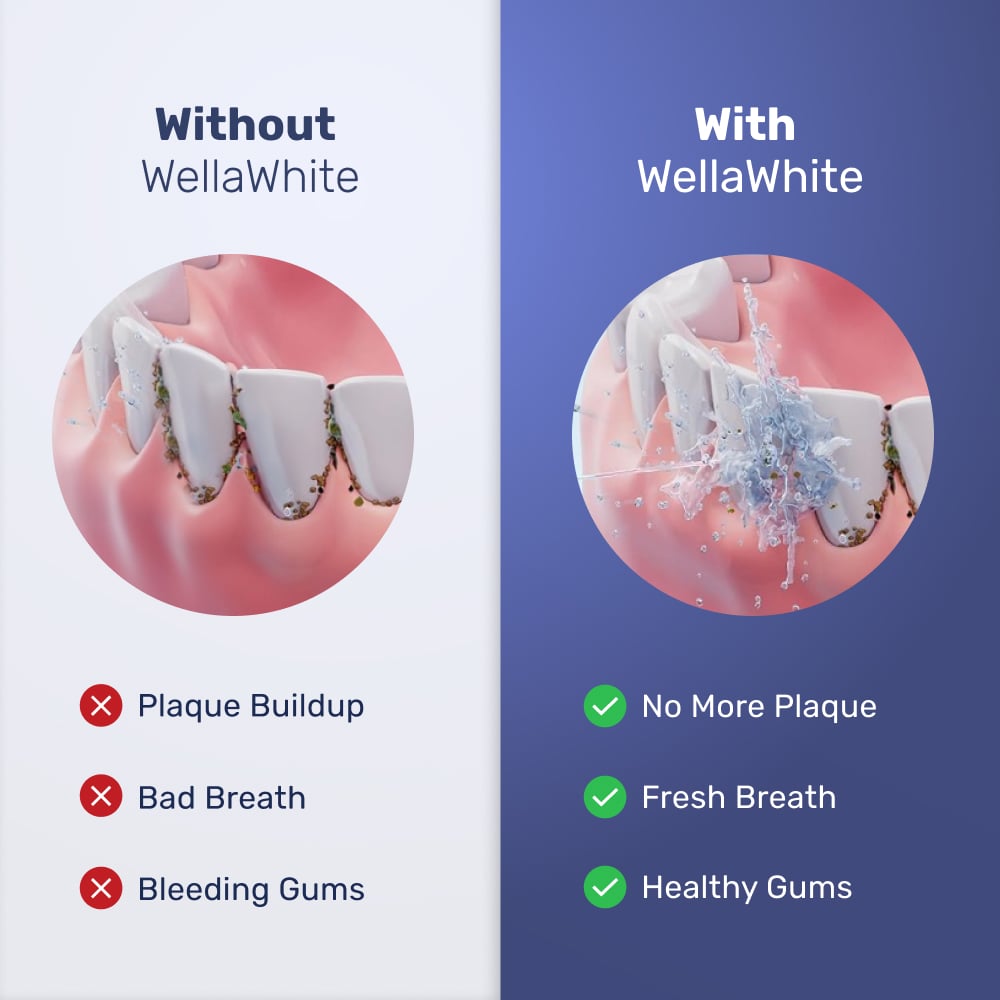 Clean & Healthy Gums With WellaWhite Water Flosser