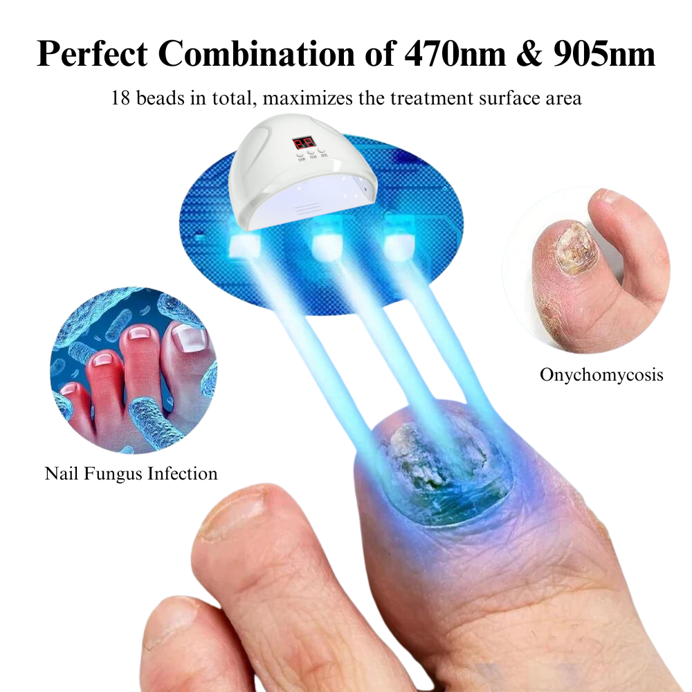 Fungus Laser Therapy Device