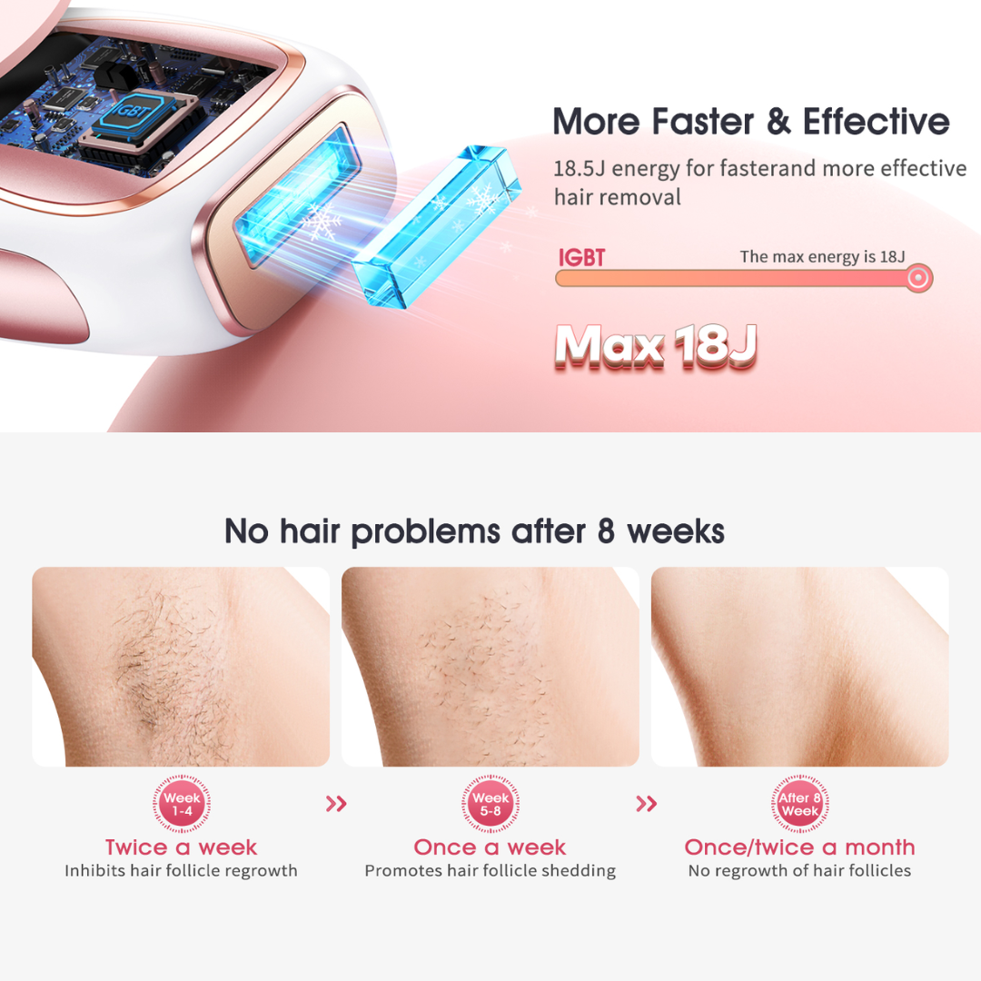 Hair Removal Laser Epilator - Comfortable, soothing hair removal experience