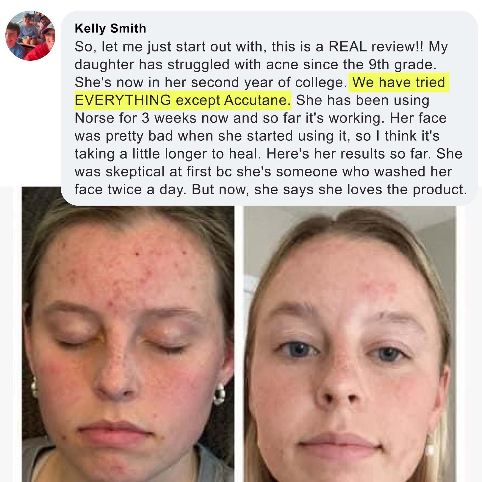 Kill Acne & Redness Ritual