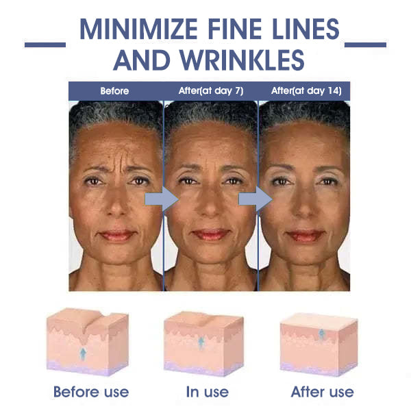 Last Day Discount 87% OFF - Advanced Firming & Wrinkle-Reducing Cream: Restore Skin Elasticity