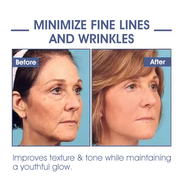 Last Day Discount 87% OFF - Advanced Firming & Wrinkle-Reducing Cream: Restore Skin Elasticity