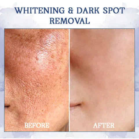 Last Day Discount 87% OFF - Advanced Firming & Wrinkle-Reducing Cream: Restore Skin Elasticity