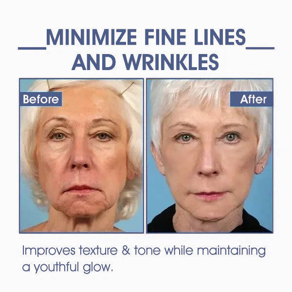 Last Day Discount 87% OFF - Advanced Firming & Wrinkle-Reducing Cream: Restore Skin Elasticity