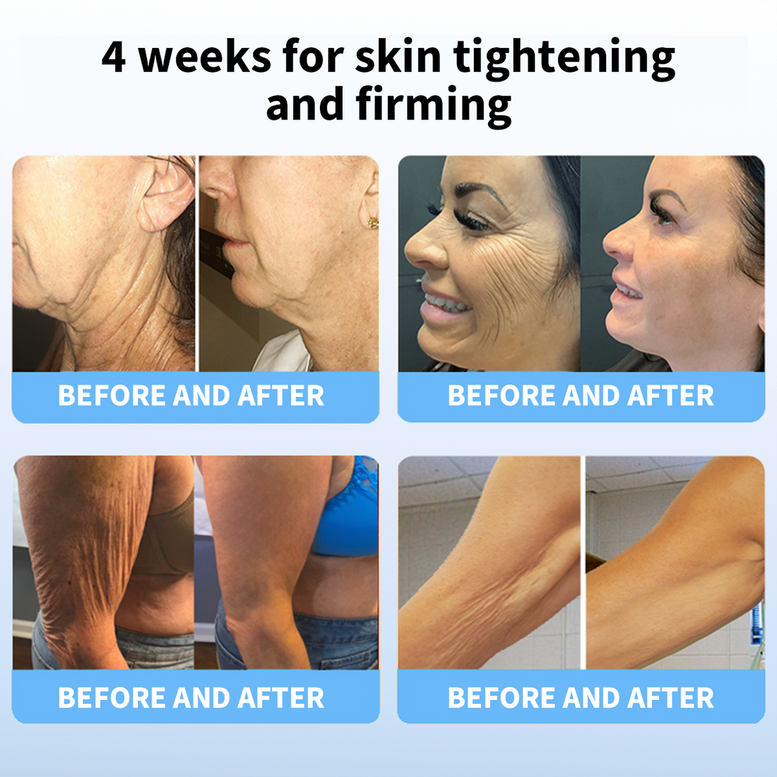 Last Day Discount 87% OFF - Advanced Firming & Wrinkle-Reducing Cream: Restore Skin Elasticity