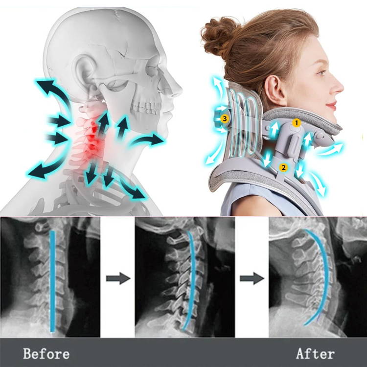 KyroLabs CERVIFLEX Neck Stretcher