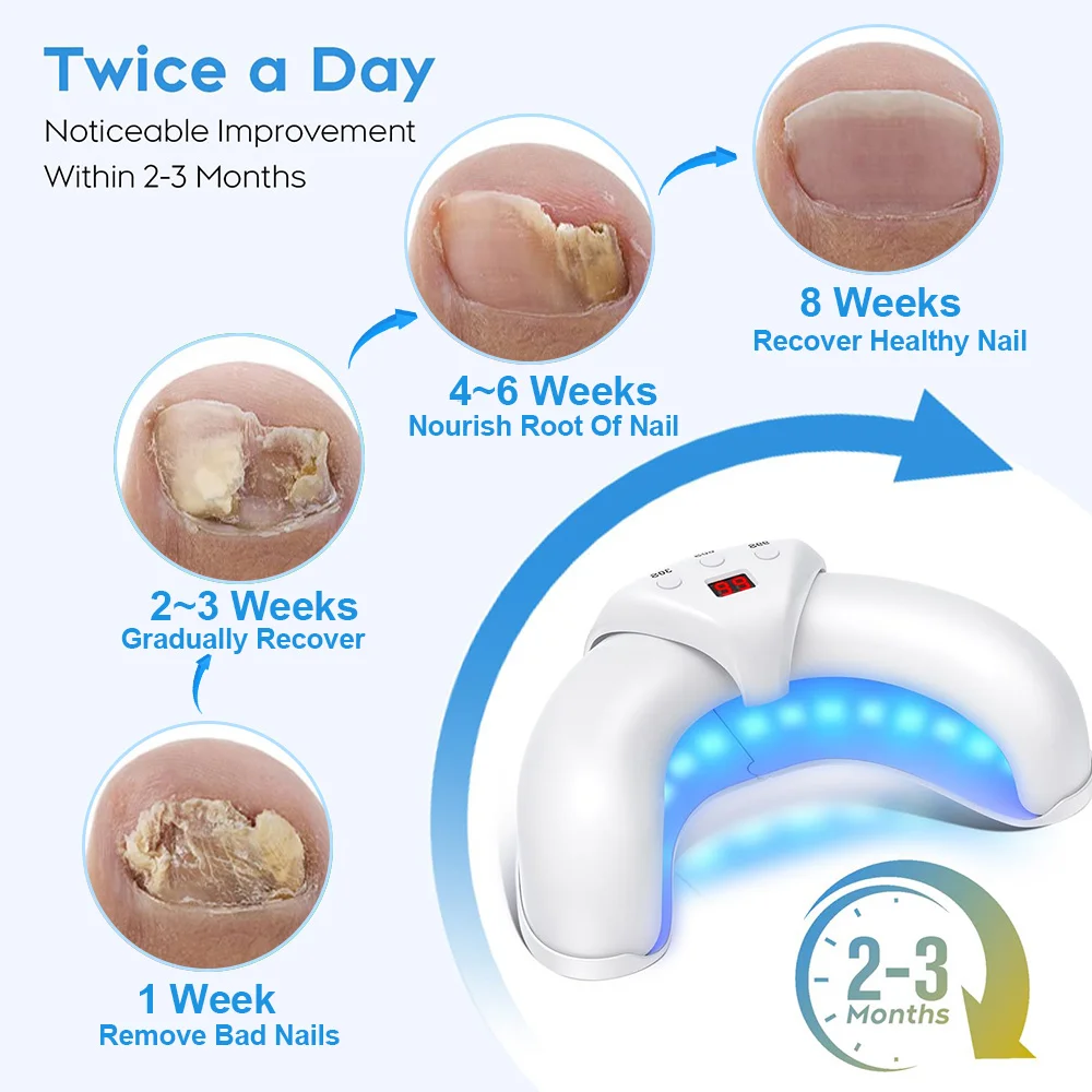 Neoclear Antifungal Device