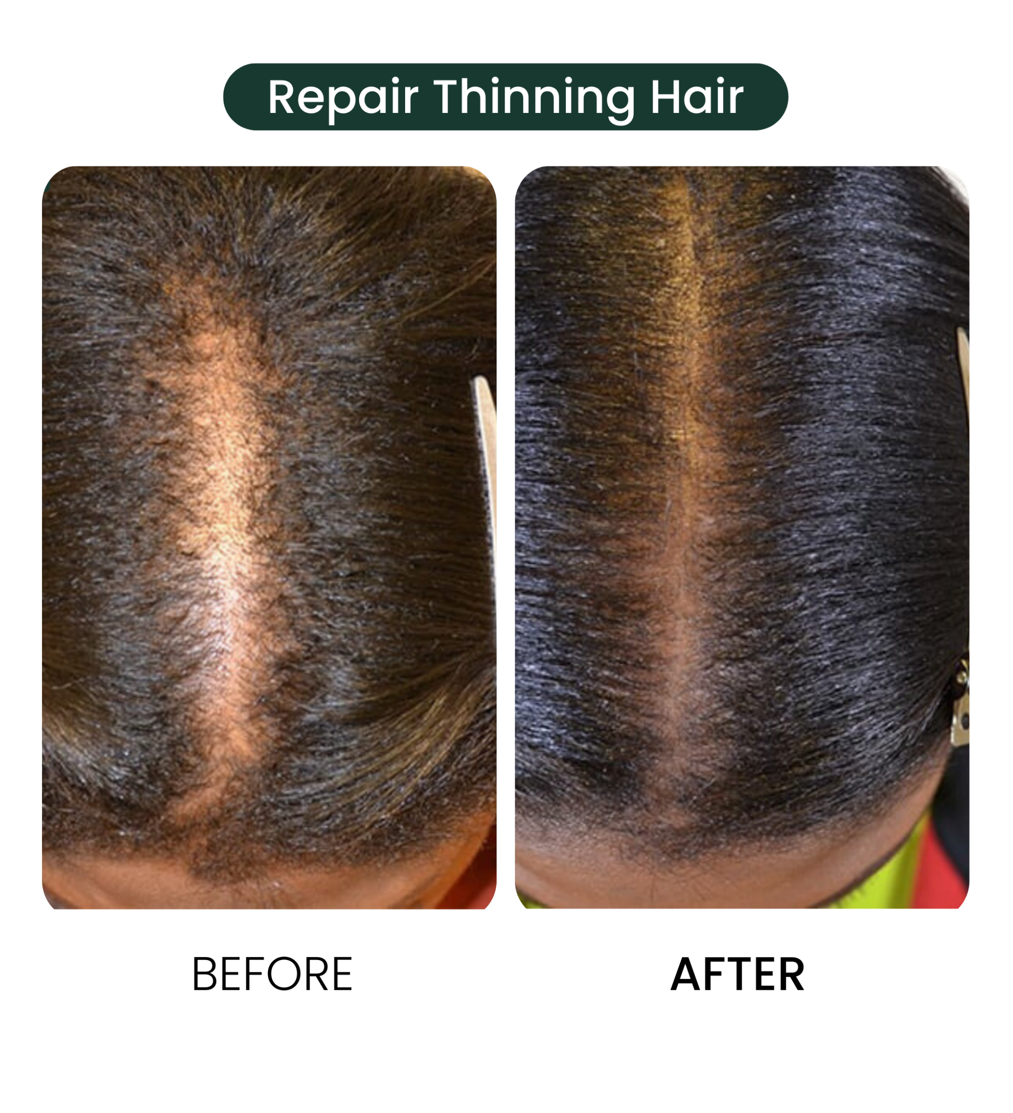 Overnight Batana Oil for Natural Hair Growth