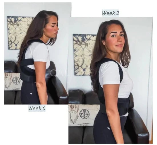 PosturePal Posture Corrector