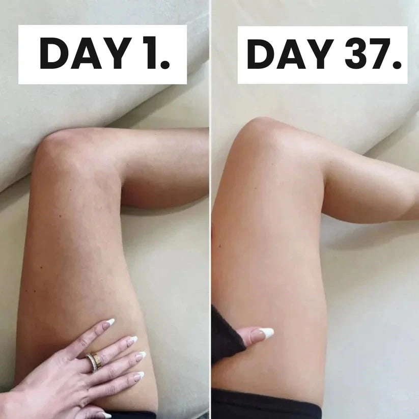 SleekPhysique | Smooth, Sexy Legs in 7 Days