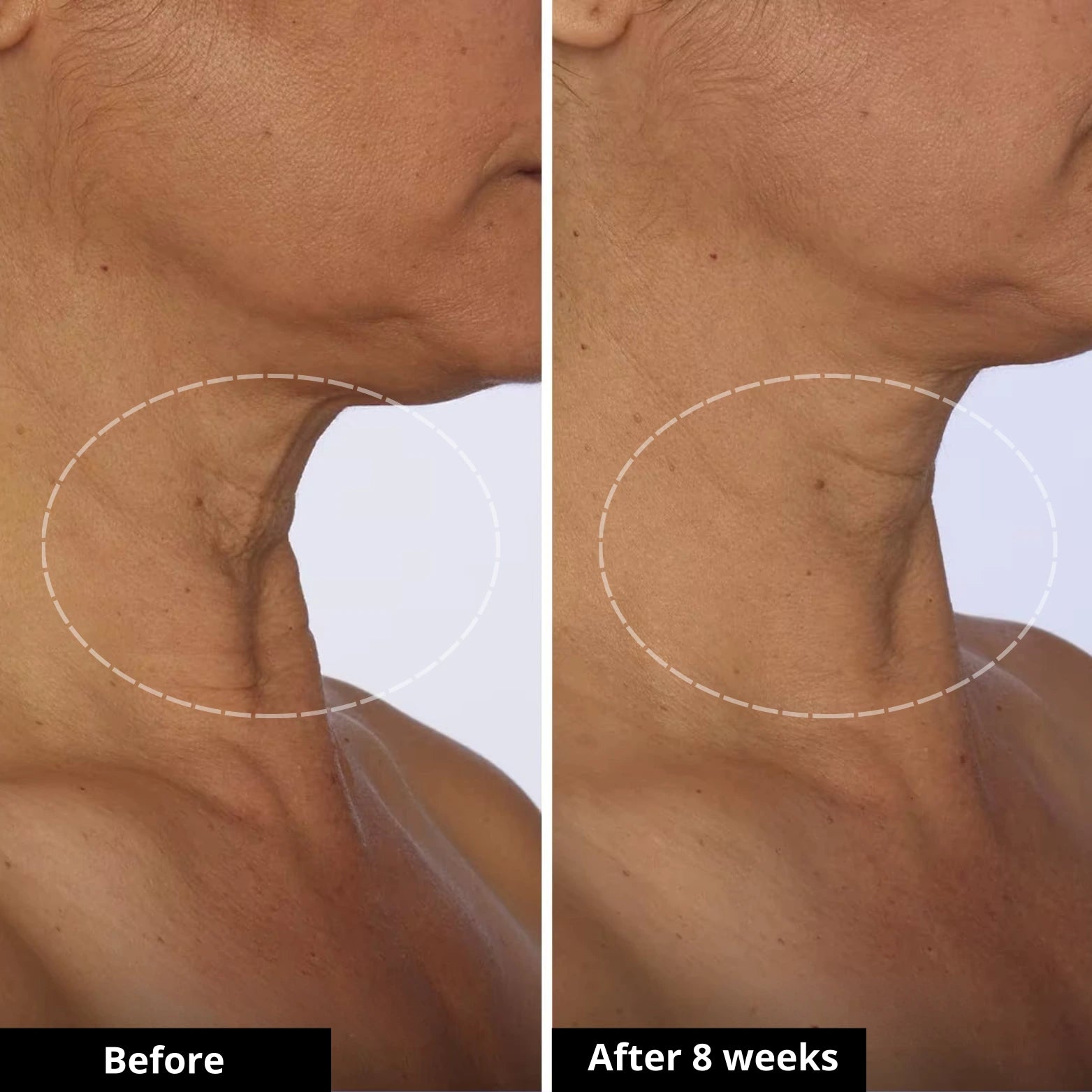 Tighten & Lift Neck Cream