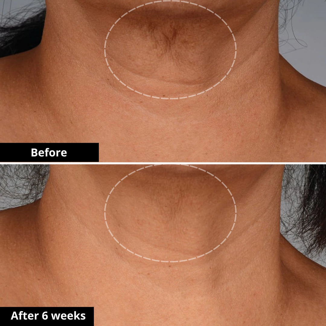 Tighten & Lift Neck Cream