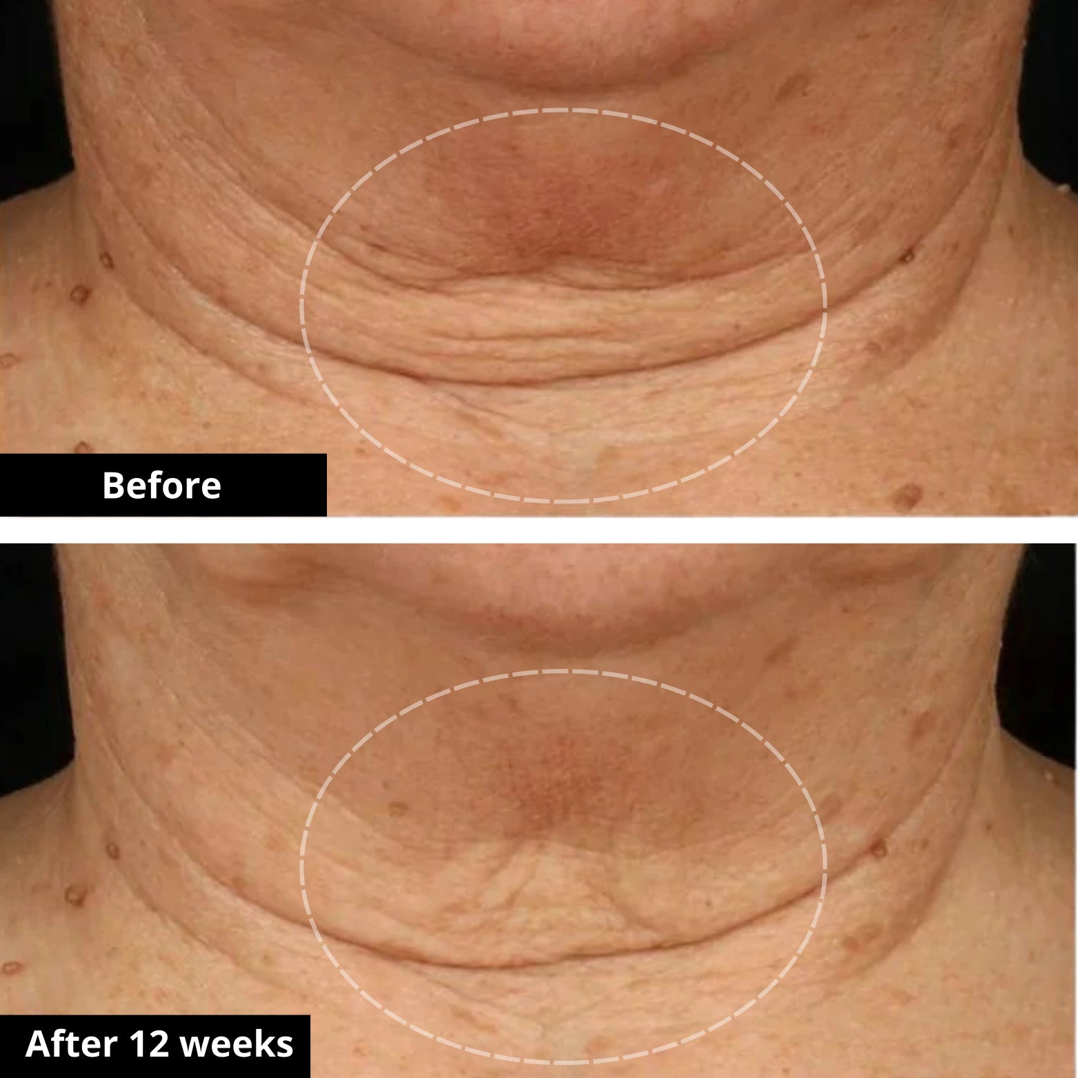 Tighten & Lift Neck Cream