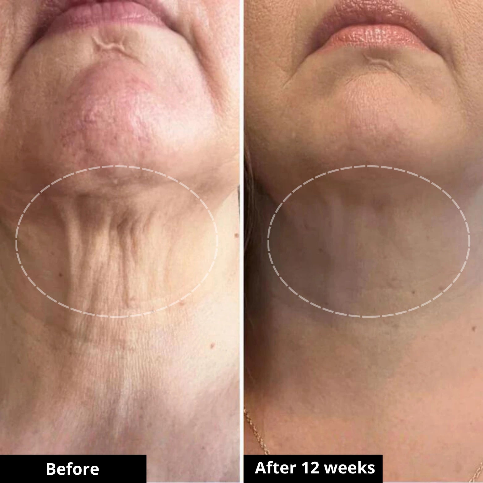 Tighten & Lift Neck Cream